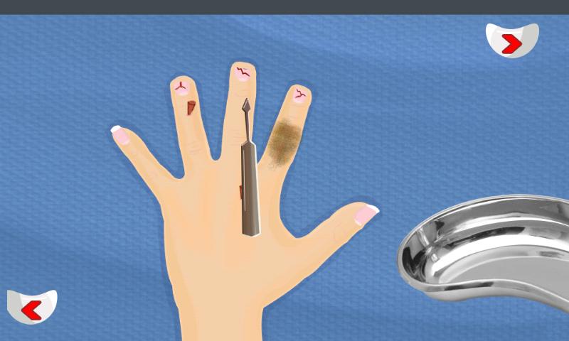 Finger Surgery Doctor